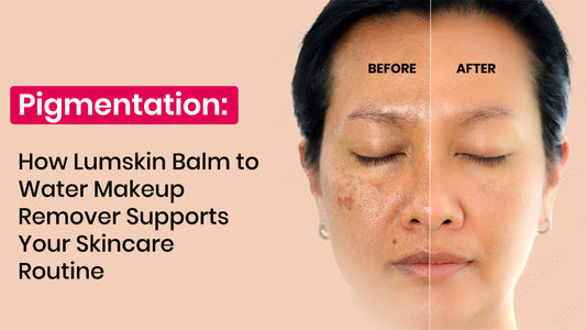 Pigmentation: How Lumskin Balm to Water Makeup Remover Supports Your Skincare Routine